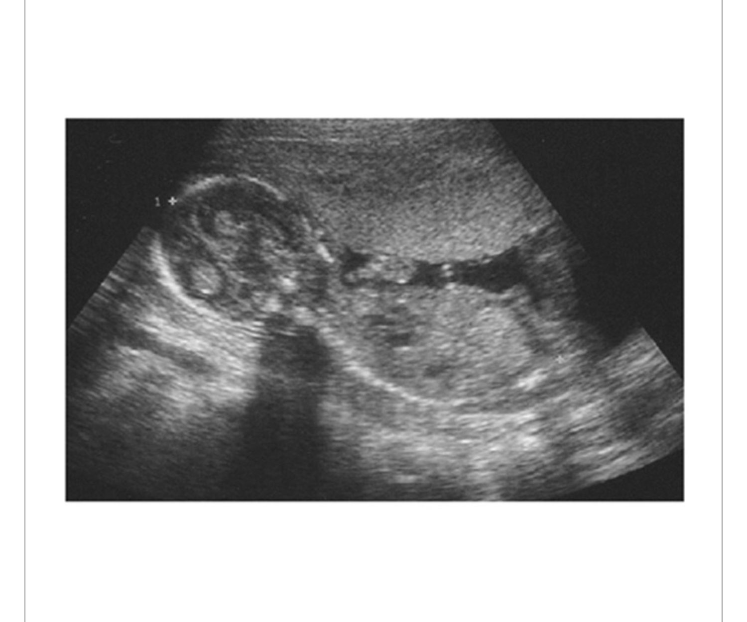 2011.01.19 Release!  2nd Single Album